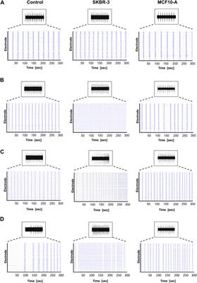Electrophysiological and morphological modulation of neuronal-glial network by breast cancer and nontumorigenic mammary cell conditioned medium